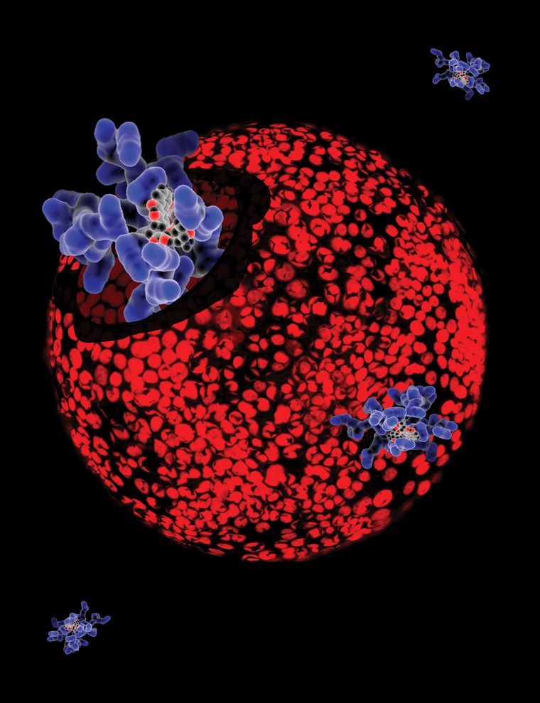 Picture of prostate cancer cells treated with nano sized drug carriers
