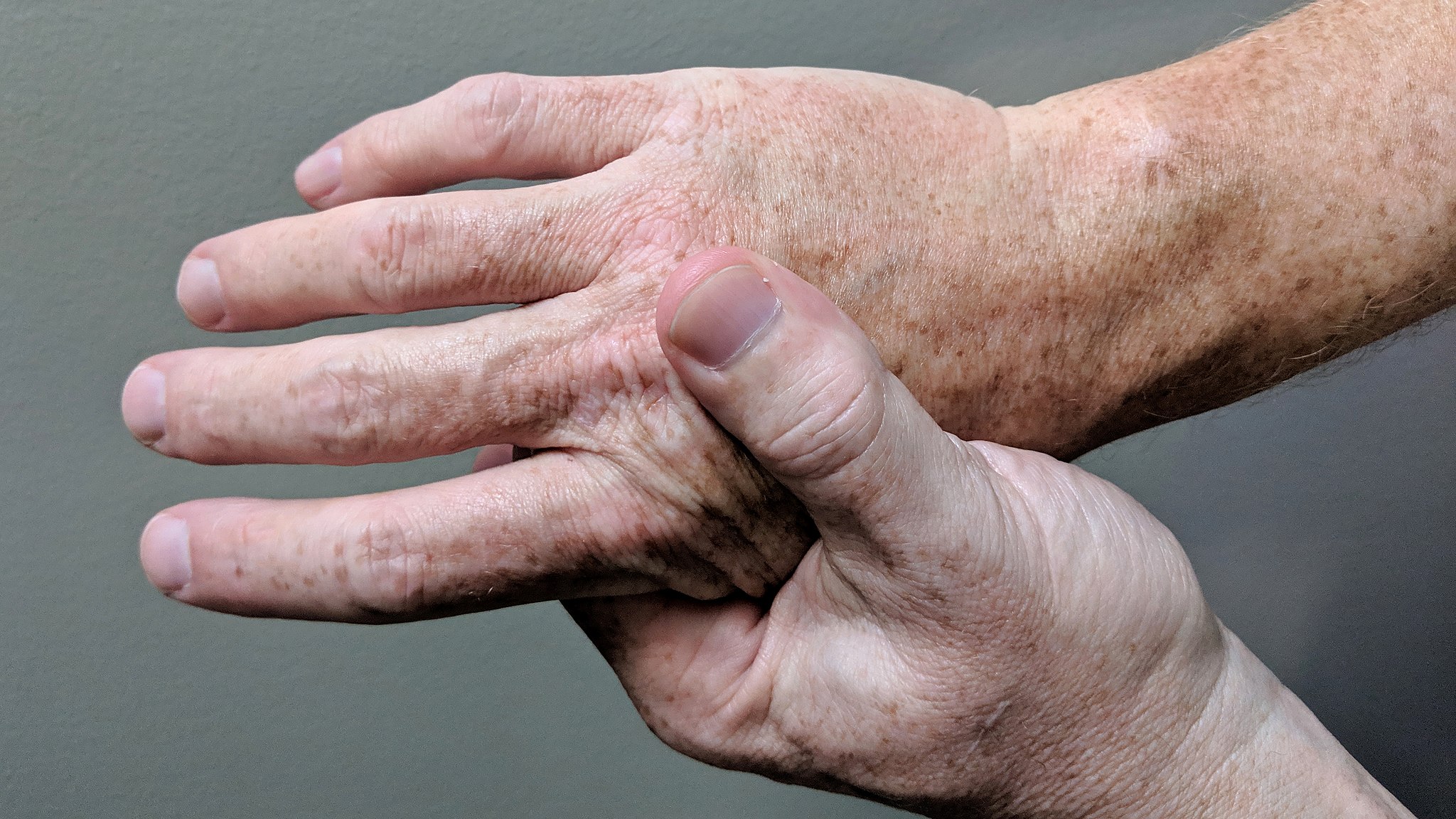Picture of one hand rubbing another