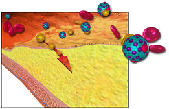 Illustration of cholesterol affecting the blood vessels