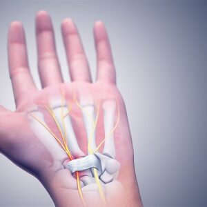 Picture of a hand with bones and nerves visible